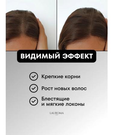 Lauroma Hair growth with rosemary - Buy Online on GoSupps.com