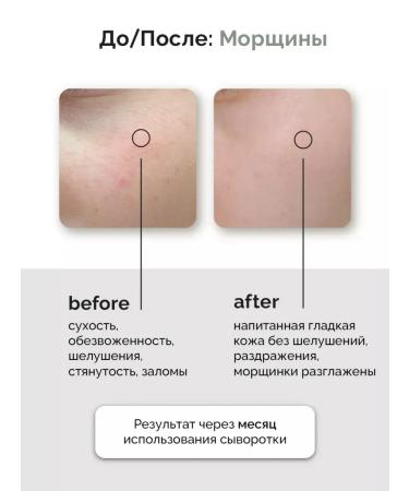 Kaine CHIGALING CHAGA COLLAGEN SERUM - Buy Online on GoSupps.com