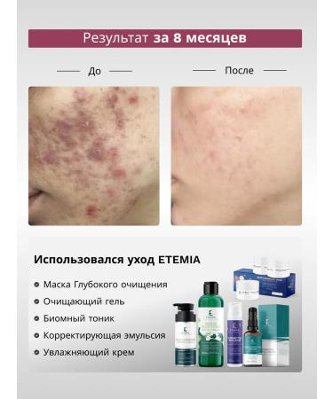 Etemia Mask for cleansing Deep Cleansing Mask Aha + Salicylate - Buy Online on GoSupps.com