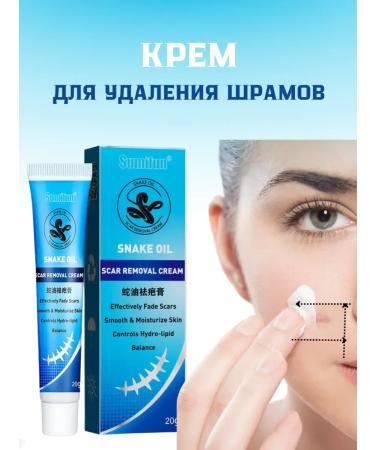 NUNA Cream from stretch marks and scars scars and post -acne