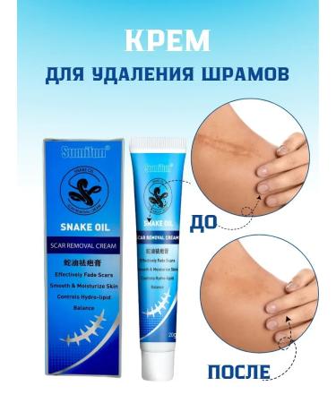 NUNA Cream from stretch marks and scars scars and post -acne - Buy Online on GoSupps.com