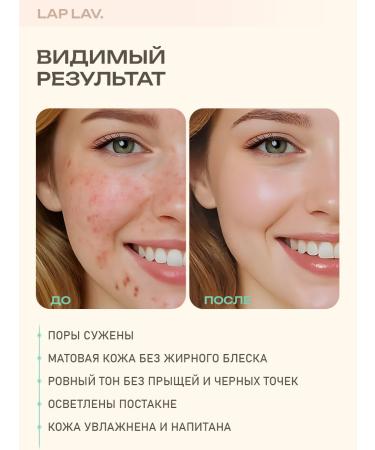 LapLav Facial serum from acne and acne - Buy Online on GoSupps.com