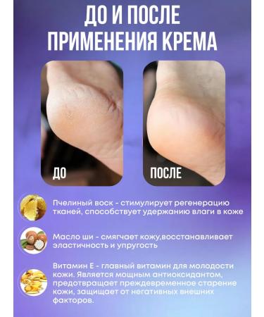 Nic r Cream from cracks and peeling and silicone hardsters - Buy Online on GoSupps.com