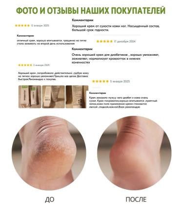 Preventin Moisturizer from fractures with urea 15% - Buy Online on GoSupps.com