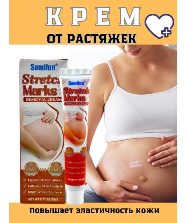 AlexaY Moisturizing anti-stretch mark cream for pregnant women