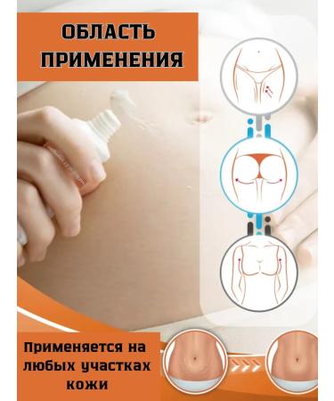 AlexaY Moisturizing anti-stretch mark cream for pregnant women - Buy Online on GoSupps.com