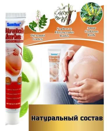 AlexaA Moisturizing anti-stretch mark cream for pregnant women - Buy Online on GoSupps.com