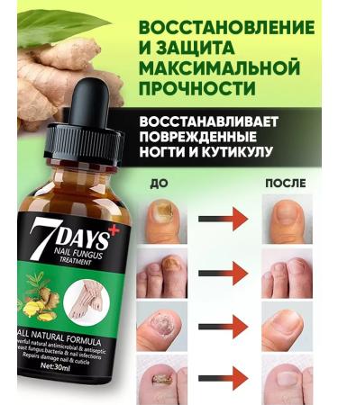 Mooyam Medical remedy for nail fungus serum 7 days - Buy Online on GoSupps.com