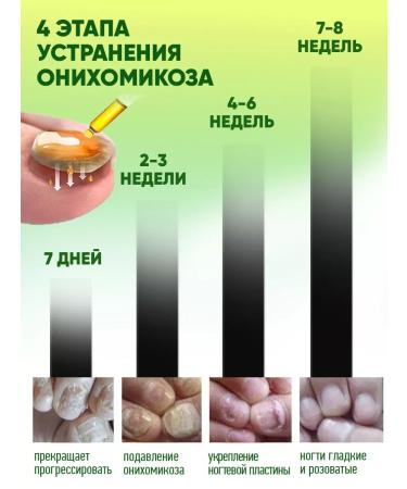 Mooyam Medical remedy for nail fungus serum 7 days - Buy Online on GoSupps.com