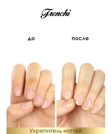 FRENCH Smart enamel fortifier with protein and vitamins - Buy Online on GoSupps.com