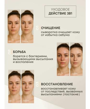 Biomixlab Facial serum with niacinamide 10% of acne - Buy Online on GoSupps.com