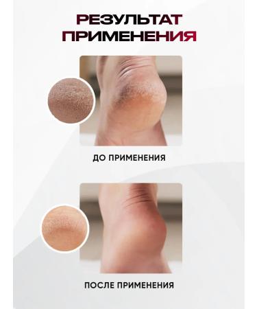 Crimean Pharmacy Foot balm from cracks and dryness set - Buy Online on GoSupps.com