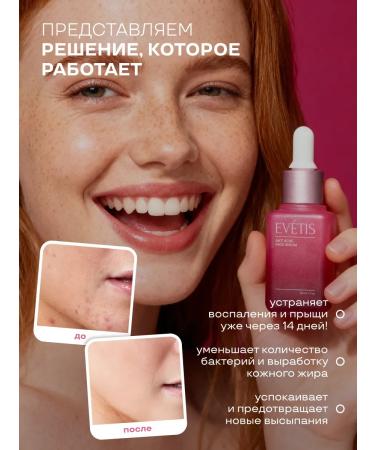 EVETIS Facial serum from acne with niacinamide - Buy Online on GoSupps.com