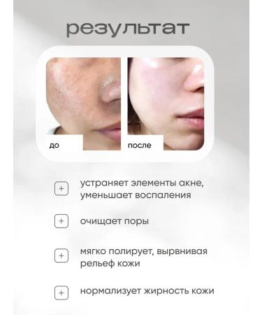 ARAVIA Professional Regenerating peeling with azelainic acid for the face - Buy Online on GoSupps.com