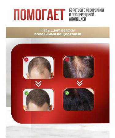 YIGANERJING Anti-hair loss serum - Buy Online on GoSupps.com