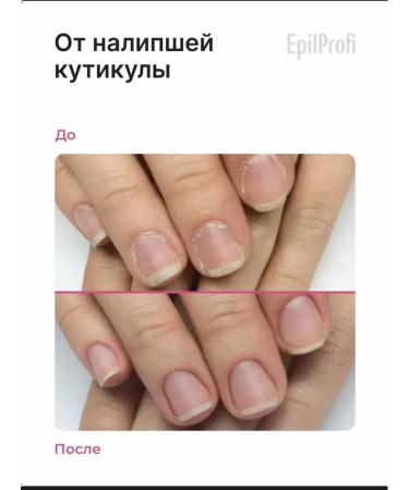 EpilProfi Night and skin leather - Buy Online on GoSupps.com