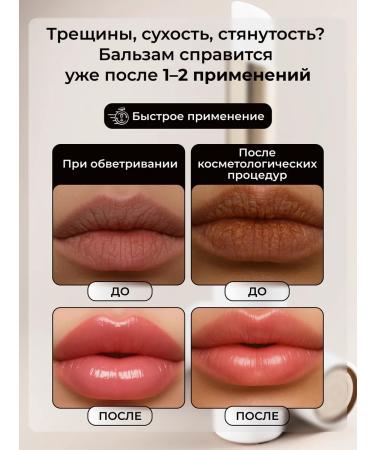 Bonimed Lip balm moisturizing and healing - Buy Online on GoSupps.com