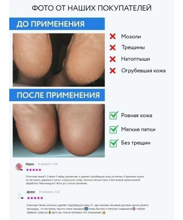 ARAVIA Professional Penfaeener for removing corns and corns - Buy Online on GoSupps.com