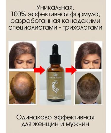 Clarice Bonnet Shampoo dandruff set balm hair serum - Buy Online on GoSupps.com