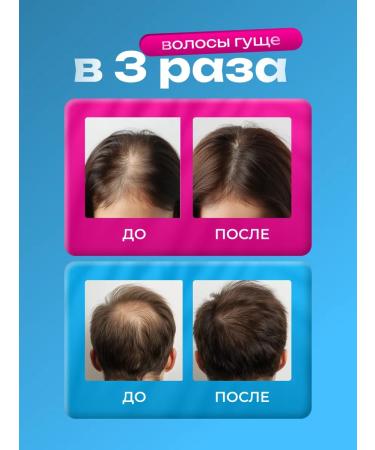 lvcos T Hair growth serum on the head - Buy Online on GoSupps.com