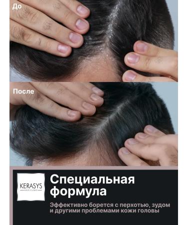 KeraSys Male hair shampoo from dandruff of scalp treatment - Buy Online on GoSupps.com
