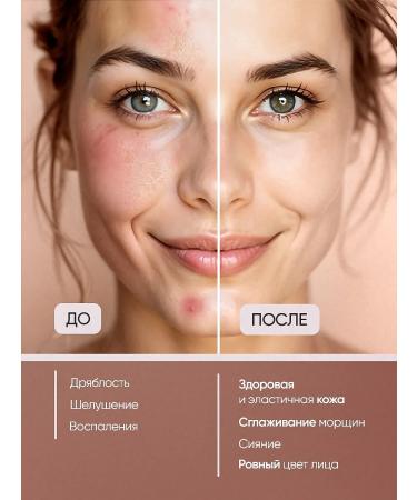 BabeKate Moisturizing face for normal and dry skin of women - Buy Online on GoSupps.com