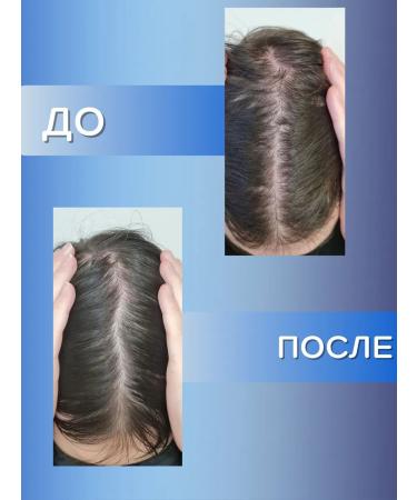 KRASSA Med shampoo for sensitive skin - Buy Online on GoSupps.com