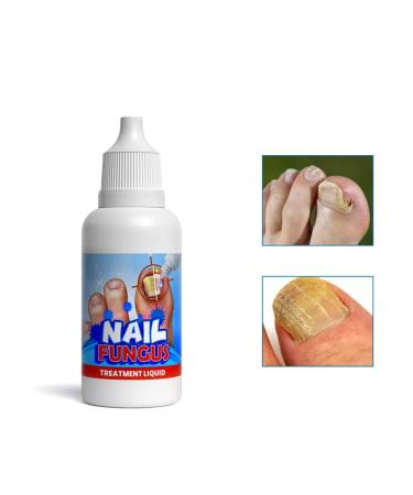 From the fungus of the nails on the legs - Buy Online on GoSupps.com