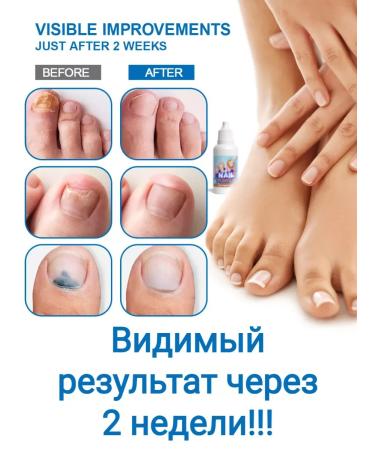 From the fungus of the nails on the legs - Buy Online on GoSupps.com