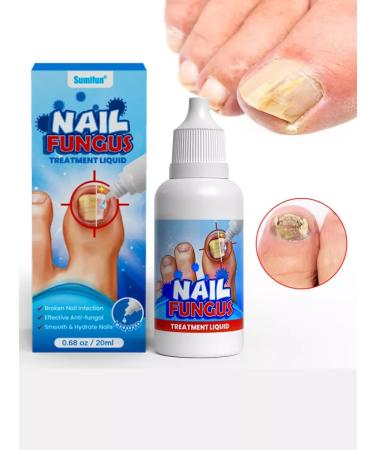From the fungus of the nails on the legs - Buy Online on GoSupps.com