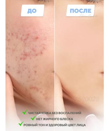 Skin1004 Caling a serum for a person with a centella of 100 ml - Buy Online on GoSupps.com