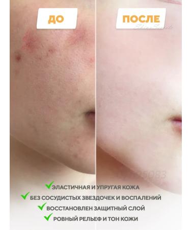 Skin1004 Restorative serum for a face with probiotics 50 ml - Buy Online on GoSupps.com