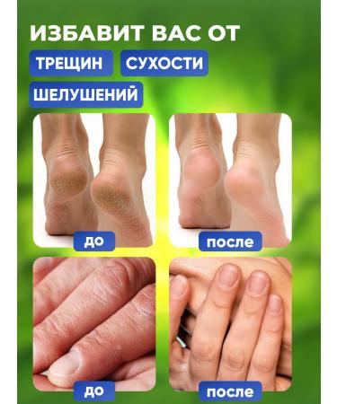 Beauty Nation Cream wax from cracks and dryness with urea 90g - Buy Online on GoSupps.com