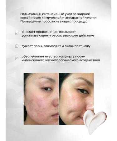 ARAVIA Professional Soothing Mask: A cooling soothing mask for post-cleansing skin. - Buy Online on GoSupps.com