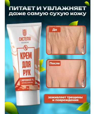 SYSTEM Cosmetic Hand cream with urea 7% for dry skin - Buy Online on GoSupps.com