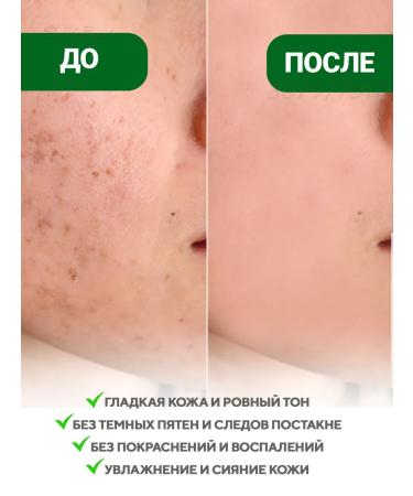 AXIS-Y Serum from pigment spots on the face of the clarifying - Buy Online on GoSupps.com