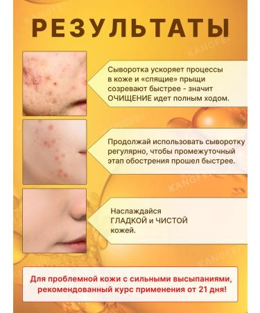 KANGFEI Facial serum from acne and acne with salicylic acid - Buy Online on GoSupps.com