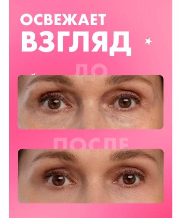 BELITA Eye gel cream is a radiant look against swelling 30 ml - Buy Online on GoSupps.com