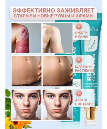 sadoer Cream gel from scars and scars acne burns on the face and body - Buy Online on GoSupps.com