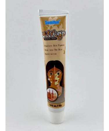 GChe Cream against the pigmentation of the skin of vitiligo white spots - Buy Online on GoSupps.com