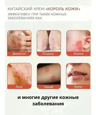 Chinese miracle ointment Skin karol ointment from skin diseases - Buy Online on GoSupps.com