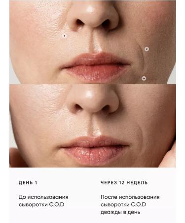 Zoefrero Moisturizing anti -aging serum from wrinkles - Buy Online on GoSupps.com