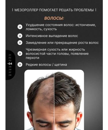 Derma Roller System Mesoroller - Buy Online on GoSupps.com