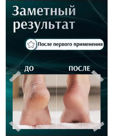 Topshop Nano foot grater pellet saw - Buy Online on GoSupps.com