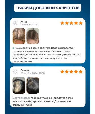 minox-boost The same 5% (3pcs) for hair growth and beard - Buy Online on GoSupps.com