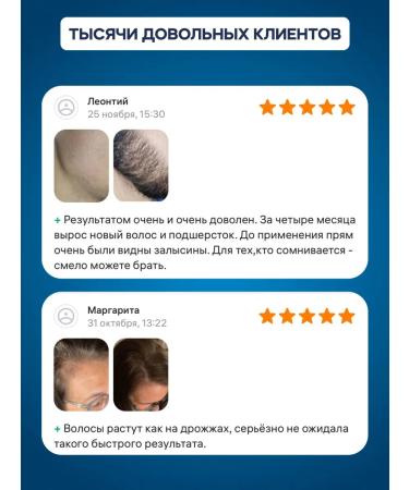 minox-boost The same 5% (2pcs) for hair growth and beard - Buy Online on GoSupps.com