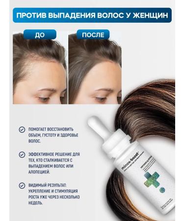 minox-boost The same 5% (2pcs) for hair growth and beard - Buy Online on GoSupps.com