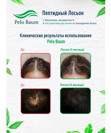 Pelo Baum Lotion Hair growth stimulator against loss of 60 ml - Buy Online on GoSupps.com