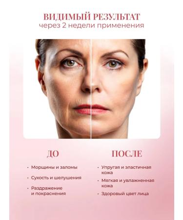 Rose of Bulgaria Facial cream ultra -level rejuvenating 50 ml - Buy Online on GoSupps.com