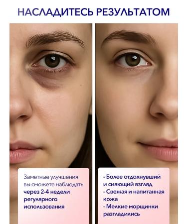 Yoghurt of Bulgaria Eyelids around the eyes anti -aging moisturizing 40 ml - Buy Online on GoSupps.com